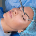 Surgery for Eyelids